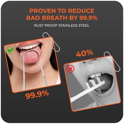 Beverly Healthcare Tongue Scraper -Shaped Tongue Cleaner, Improve Taste and Oral Health, Fresh Breath, Metal Tongue scrapers for Adults & Kids for Fresh Breath & Healthy Mouth